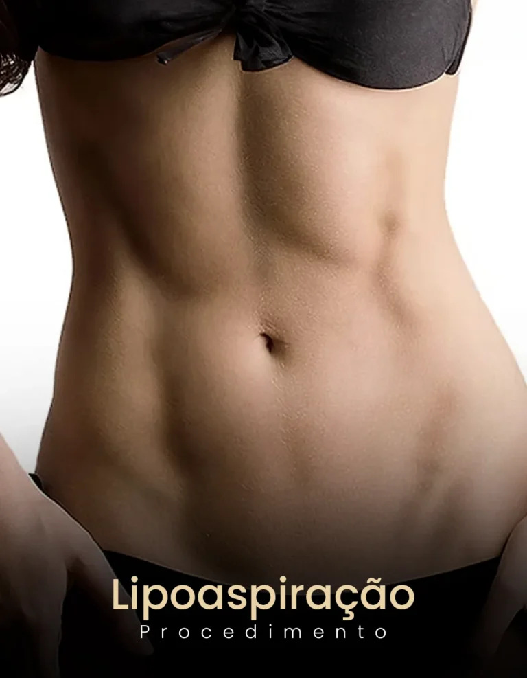 im4-convertido-de-png